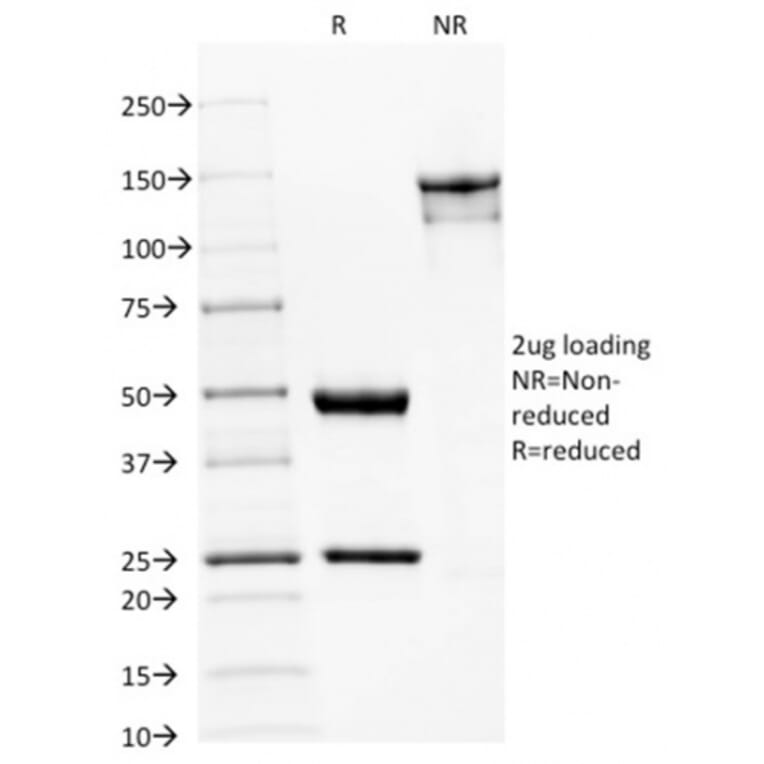 SDS-PAGE - Anti-beta III Spectrin Antibody [SPTBN2/1582] - BSA and Azide free (A253224) - Antibodies.com