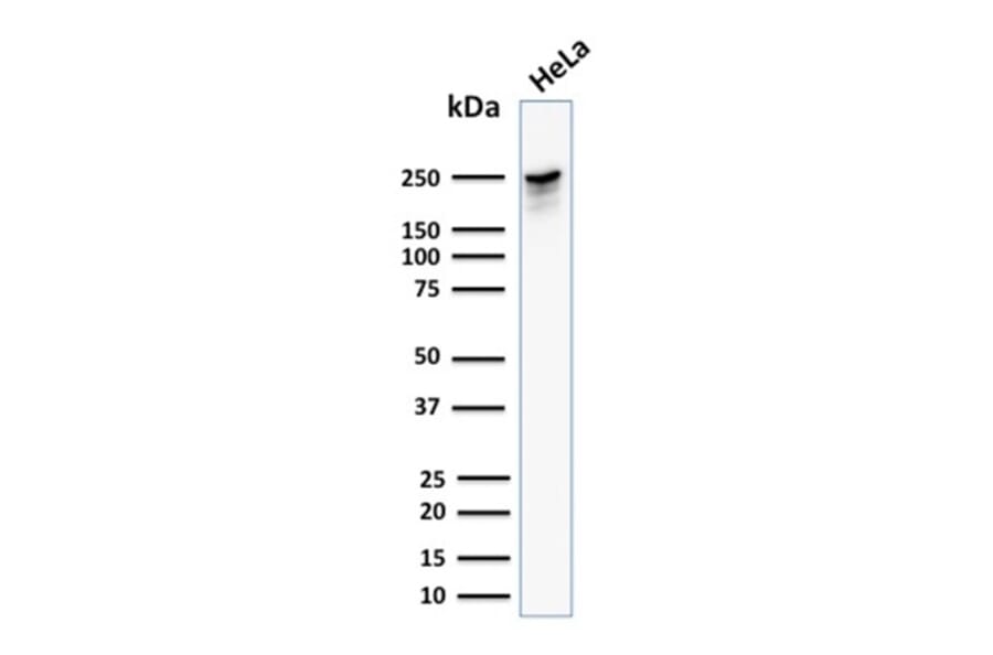 Western Blot - Anti-beta III Spectrin Antibody [SPTBN2/1582] - BSA and Azide free (A253224) - Antibodies.com