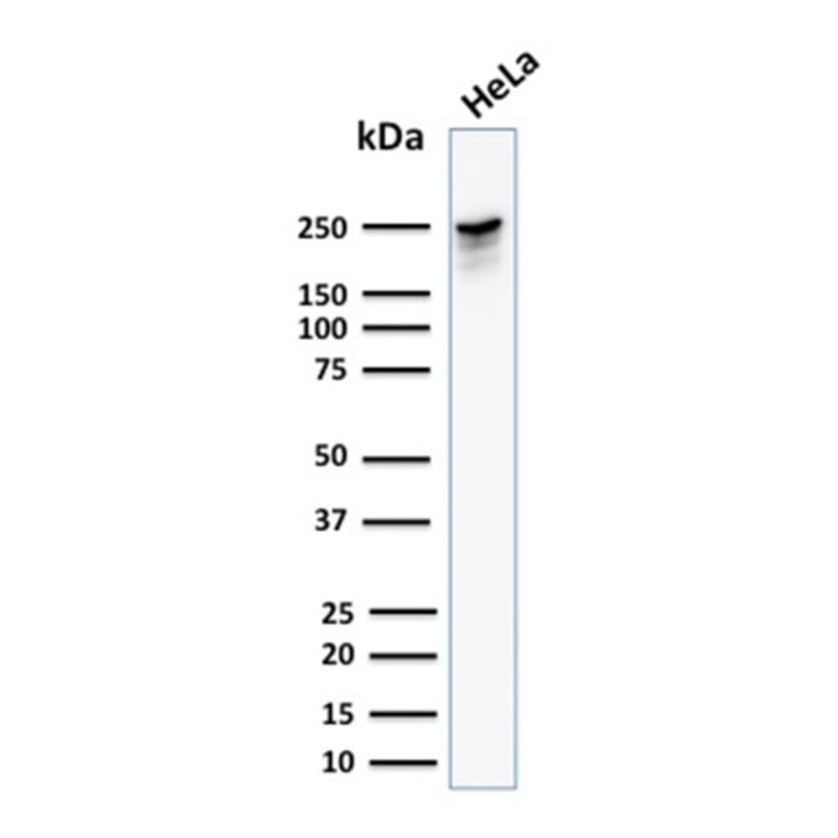 Western Blot - Anti-beta III Spectrin Antibody [SPTBN2/1582] - BSA and Azide free (A253224) - Antibodies.com