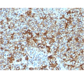 Immunohistochemistry - Anti-beta III Spectrin Antibody [SPTBN2/1583] - BSA and Azide free (A253225) - Antibodies.com