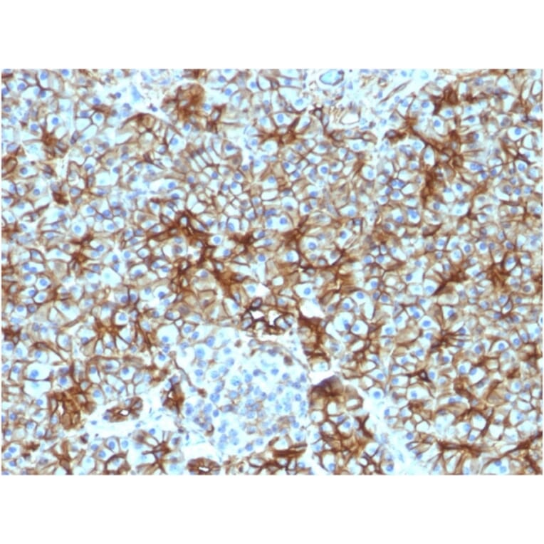 Immunohistochemistry - Anti-beta III Spectrin Antibody [SPTBN2/1583] - BSA and Azide free (A253225) - Antibodies.com