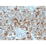 Immunohistochemistry - Anti-beta III Spectrin Antibody [SPTBN2/1583] - BSA and Azide free (A253225) - Antibodies.com