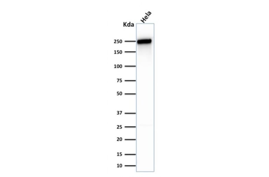Western Blot - Anti-beta III Spectrin Antibody [SPTBN2/1583] - BSA and Azide free (A253225) - Antibodies.com