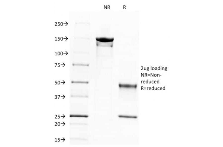 SDS-PAGE - Anti-beta III Spectrin Antibody [SPTBN2/1583] - BSA and Azide free (A253225) - Antibodies.com