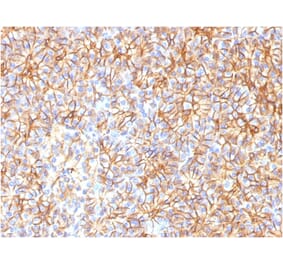 Immunohistochemistry - Anti-beta III Spectrin Antibody [SPTBN2/1584] - BSA and Azide free (A253226) - Antibodies.com