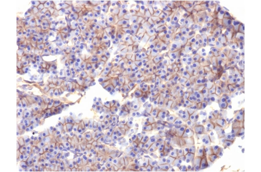 Immunohistochemistry - Anti-beta III Spectrin Antibody [SPTBN2/1584] - BSA and Azide free (A253226) - Antibodies.com