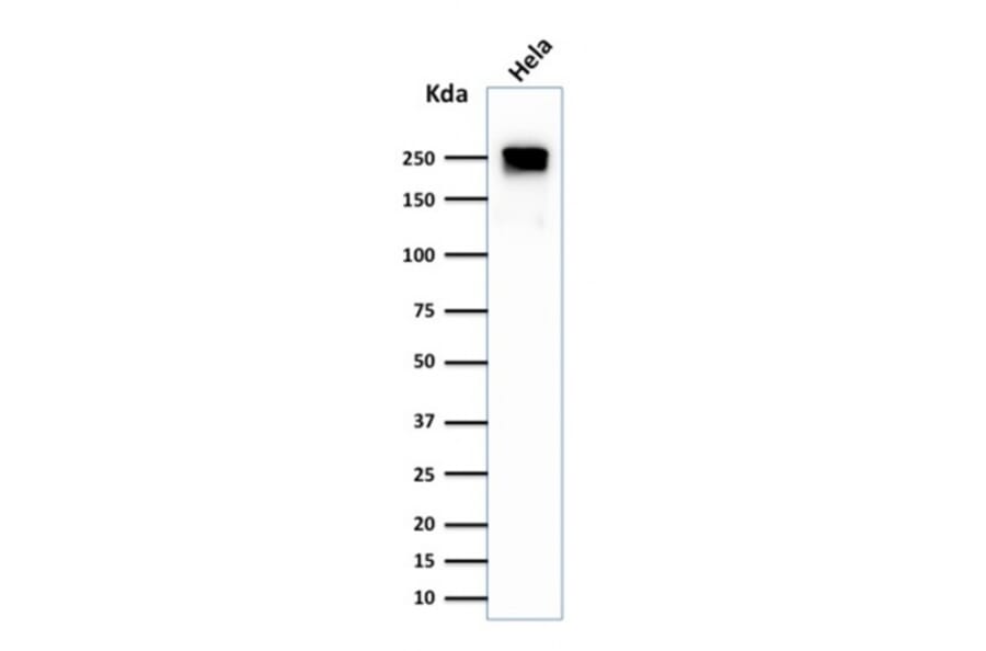 Western Blot - Anti-beta III Spectrin Antibody [SPTBN2/1584] - BSA and Azide free (A253226) - Antibodies.com