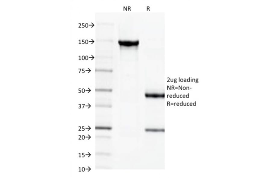 SDS-PAGE - Anti-beta III Spectrin Antibody [SPTBN2/1584] - BSA and Azide free (A253226) - Antibodies.com