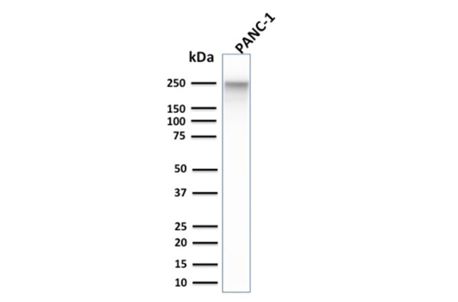 Western Blot - Anti-beta III Spectrin Antibody [SPTBN2/1584] - BSA and Azide free (A253226) - Antibodies.com
