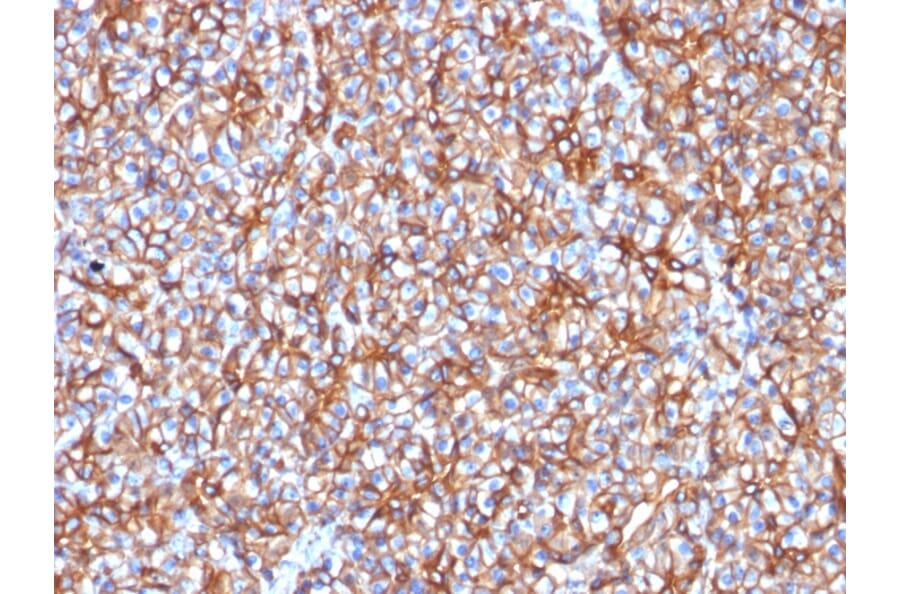 Immunohistochemistry - Anti-beta III Spectrin Antibody [SPTBN2/1778] - BSA and Azide free (A253227) - Antibodies.com