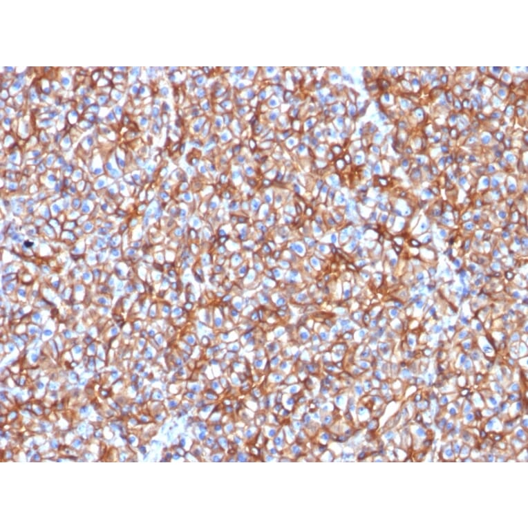 Immunohistochemistry - Anti-beta III Spectrin Antibody [SPTBN2/1778] - BSA and Azide free (A253227) - Antibodies.com