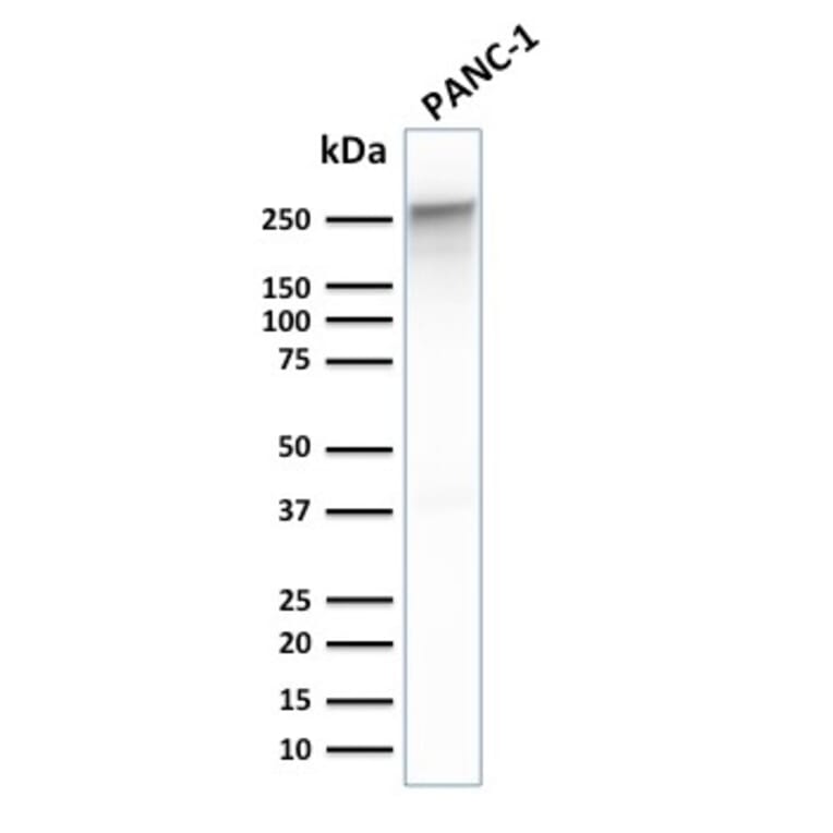 Western Blot - Anti-beta III Spectrin Antibody [SPTBN2/1778] - BSA and Azide free (A253227) - Antibodies.com