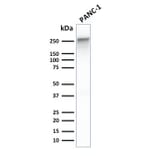 Western Blot - Anti-beta III Spectrin Antibody [SPTBN2/1778] - BSA and Azide free (A253227) - Antibodies.com
