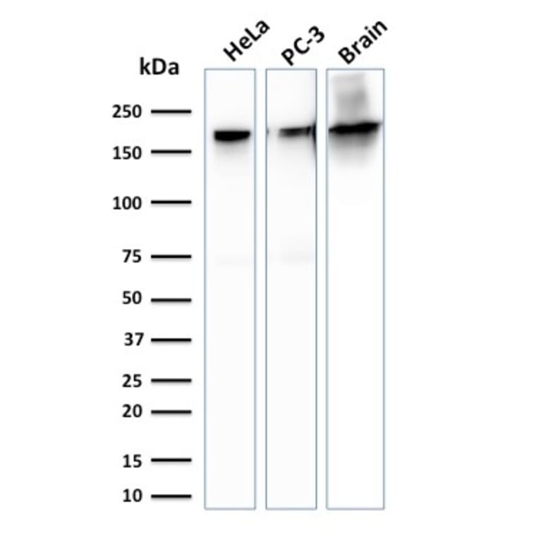 Western Blot - Anti-beta III Spectrin Antibody [SPTBN2/1778] - BSA and Azide free (A253227) - Antibodies.com