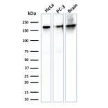 Western Blot - Anti-beta III Spectrin Antibody [SPTBN2/1778] - BSA and Azide free (A253227) - Antibodies.com