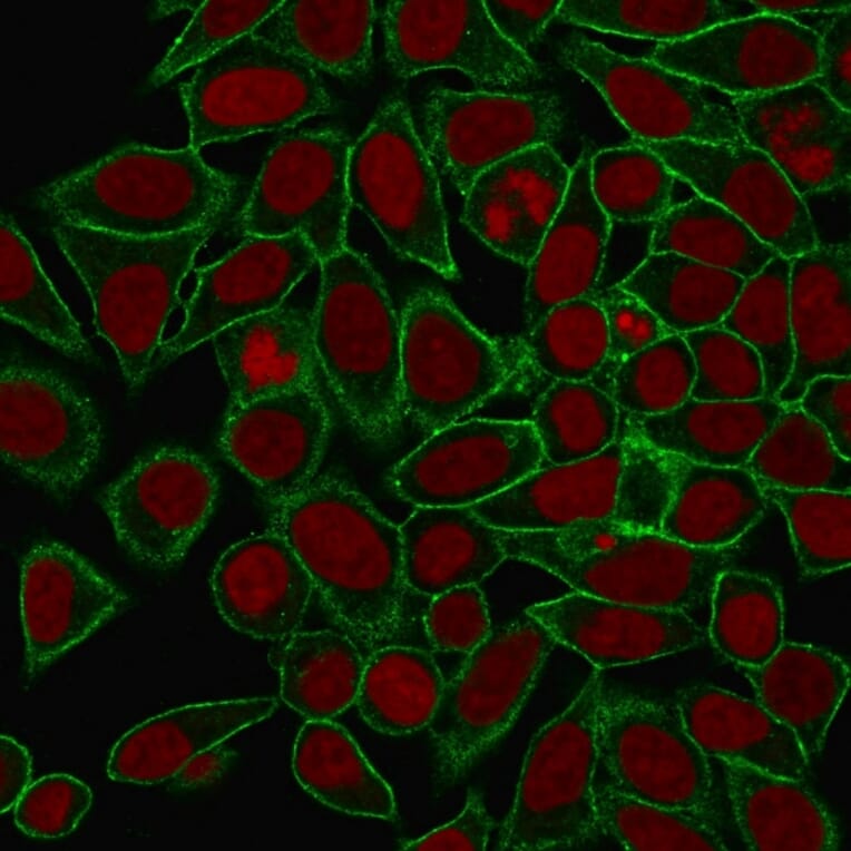 Immunofluorescence - Anti-beta III Spectrin Antibody [SPTBN2/1778] - BSA and Azide free (A253227) - Antibodies.com