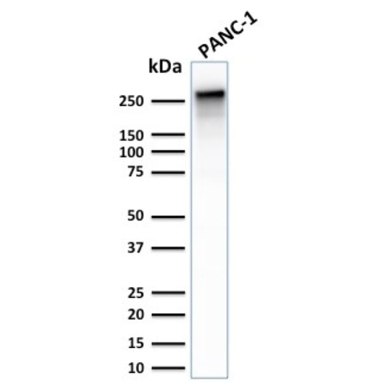 Western Blot - Anti-beta III Spectrin Antibody [SPTBN2/2887R] - BSA and Azide free (A253228) - Antibodies.com