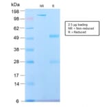 SDS-PAGE - Anti-beta III Spectrin Antibody [SPTBN2/2887R] - BSA and Azide free (A253228) - Antibodies.com