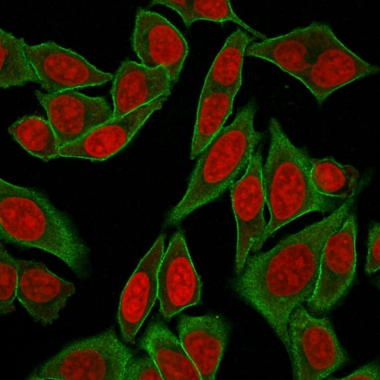 Immunofluorescence - Anti-beta III Spectrin Antibody [SPTBN2/2887R] - BSA and Azide free (A253228) - Antibodies.com