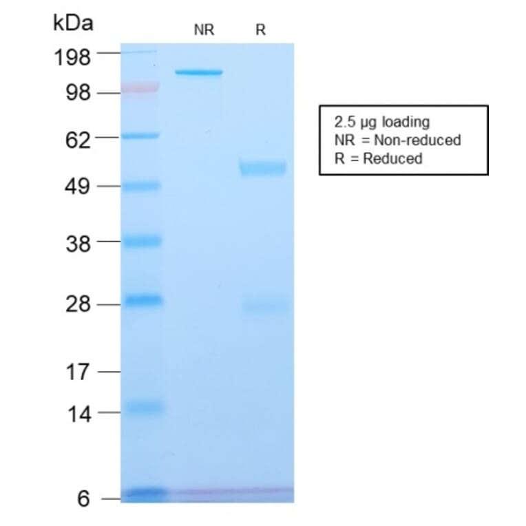 SDS-PAGE - Anti-beta III Spectrin Antibody [SPTBN2/2894R] - BSA and Azide free (A253229) - Antibodies.com