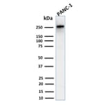 Western Blot - Anti-beta III Spectrin Antibody [SPTBN2/2894R] - BSA and Azide free (A253229) - Antibodies.com