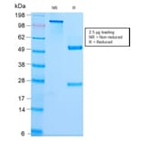 SDS-PAGE - Anti-beta III Spectrin Antibody [SPTBN2/2979R] - BSA and Azide free (A253230) - Antibodies.com