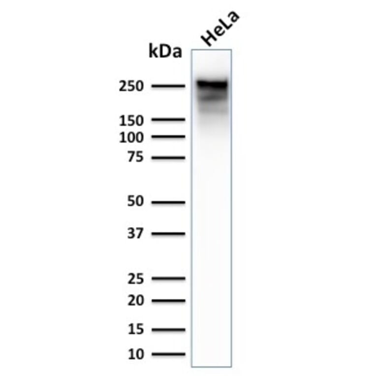 Western Blot - Anti-beta III Spectrin Antibody [SPTBN2/2979R] - BSA and Azide free (A253230) - Antibodies.com