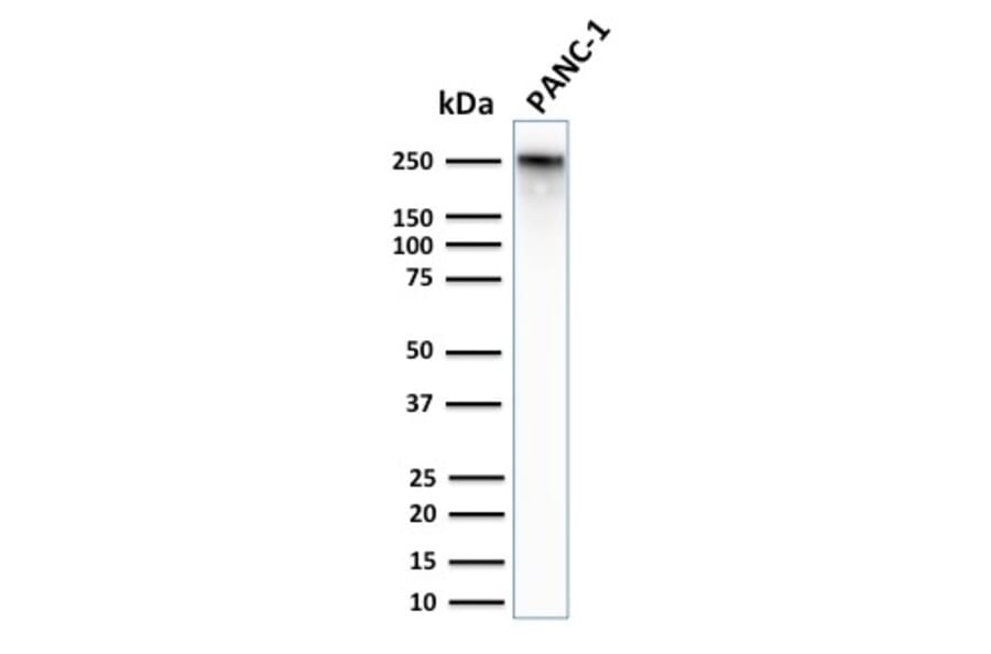 Western Blot - Anti-beta III Spectrin Antibody [SPTBN2/2979R] - BSA and Azide free (A250050) - Antibodies.com