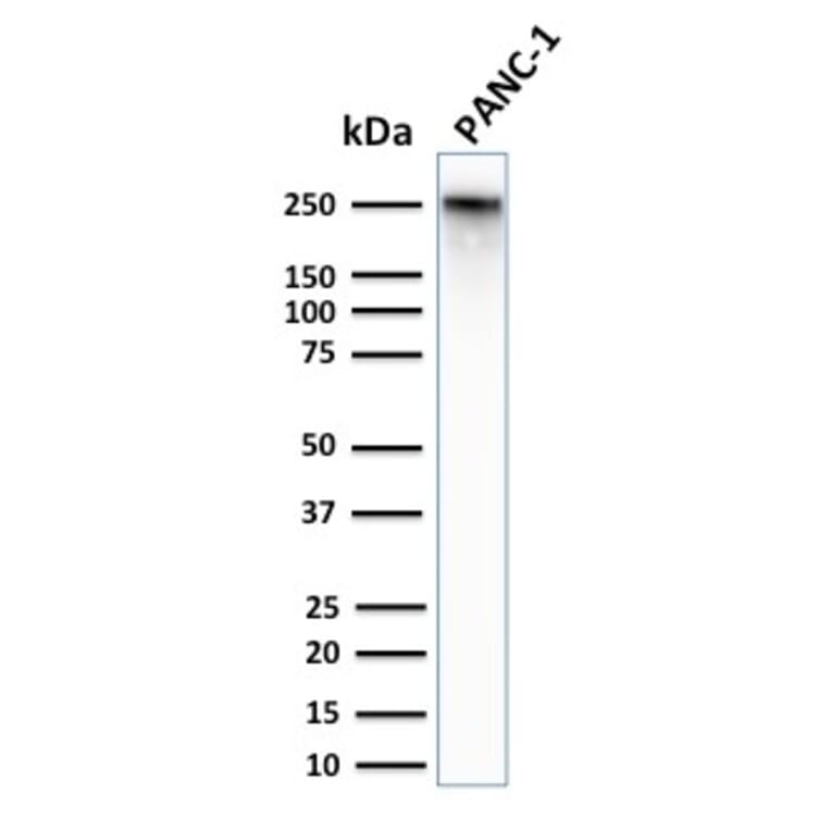 Western Blot - Anti-beta III Spectrin Antibody [SPTBN2/2979R] - BSA and Azide free (A253230) - Antibodies.com