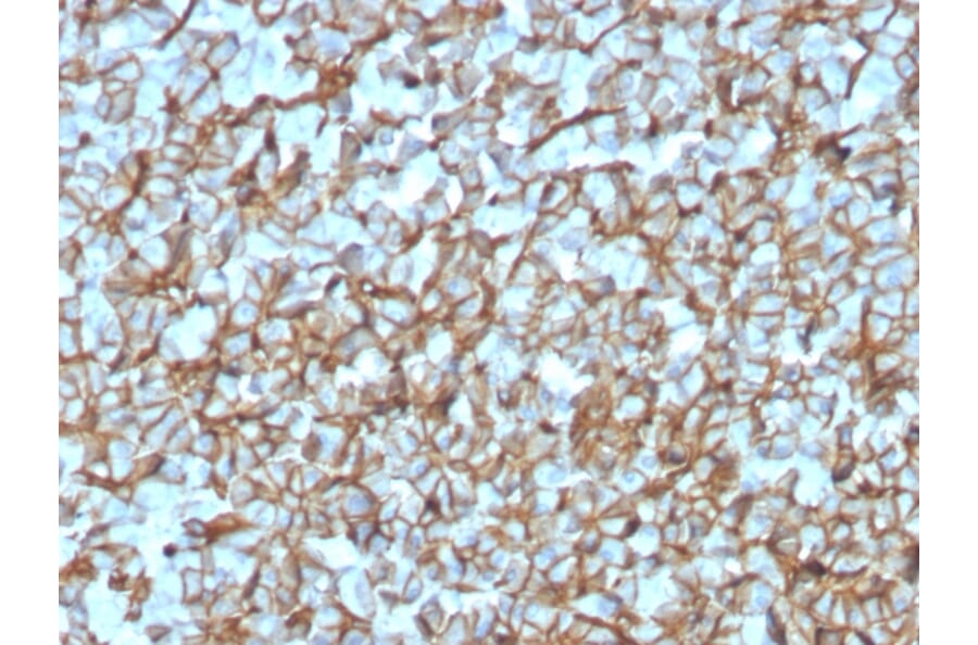 Immunohistochemistry - Anti-beta III Spectrin Antibody [SPTBN2/3142R] - BSA and Azide free (A253231) - Antibodies.com