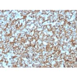 Immunohistochemistry - Anti-beta III Spectrin Antibody [SPTBN2/3142R] - BSA and Azide free (A253231) - Antibodies.com
