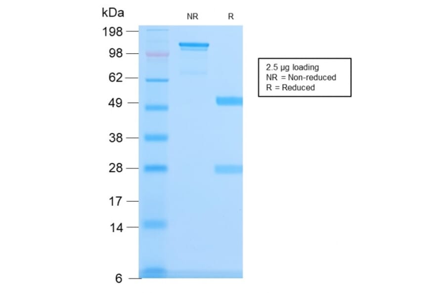SDS-PAGE - Anti-beta III Spectrin Antibody [SPTBN2/3142R] - BSA and Azide free (A253231) - Antibodies.com