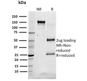 SDS-PAGE - Anti-SREBP1 Antibody [SREBP1/1578] - BSA and Azide free (A253231) - Antibodies.com