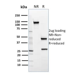 SDS-PAGE - Anti-SREBP2 Antibody [SREBP2/1579] - BSA and Azide free (A253232) - Antibodies.com