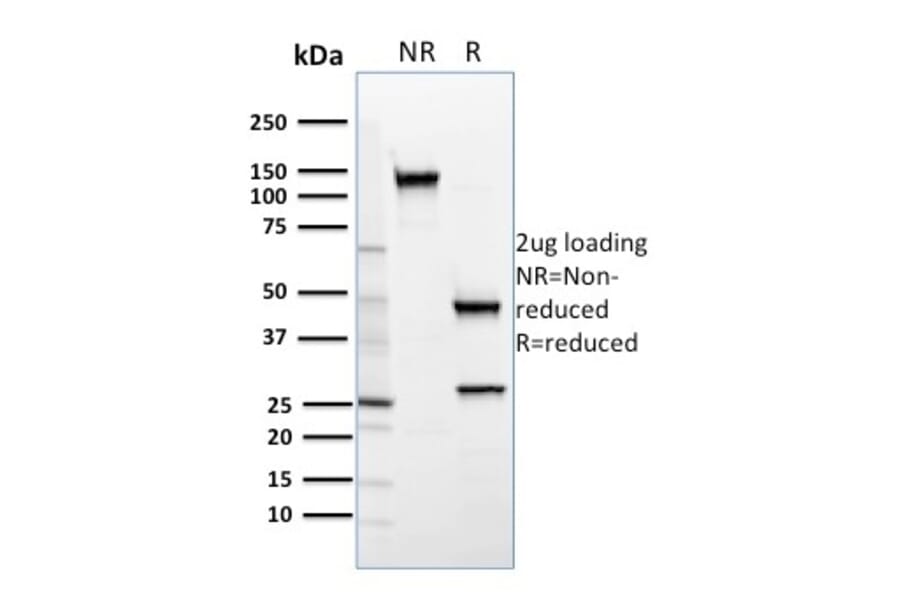 SDS-PAGE - Anti-SREBP2 Antibody [SREBP2/1579] - BSA and Azide free (A253232) - Antibodies.com