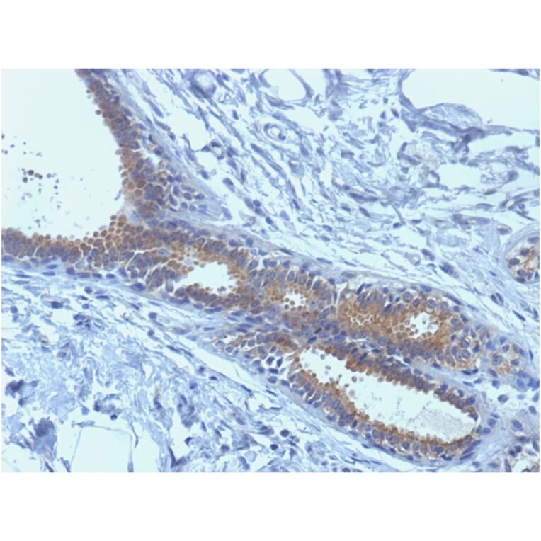 Immunohistochemistry - Anti-BRCA1 Antibody [BRCA1/1398] - BSA and Azide free (A253234) - Antibodies.com