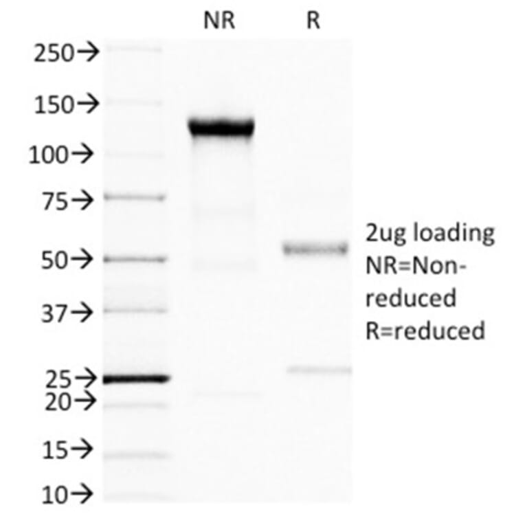 SDS-PAGE - Anti-BRCA1 Antibody [BRCA1/1398] - BSA and Azide free (A253234) - Antibodies.com