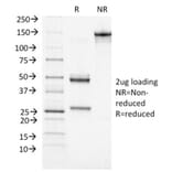SDS-PAGE - Anti-BRCA1 Antibody [BRCA1/1472] - BSA and Azide free (A253235) - Antibodies.com