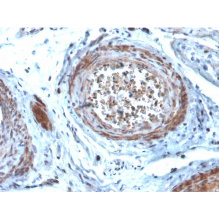 Immunohistochemistry - Anti-StAR Antibody [STAR/2077] - BSA and Azide free (A253238) - Antibodies.com