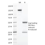SDS-PAGE - Anti-StAR Antibody [STAR/2077] - BSA and Azide free (A253238) - Antibodies.com
