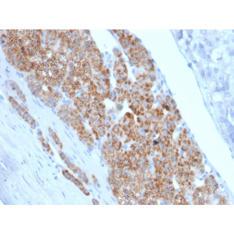 Immunohistochemistry - Anti-StAR Antibody [STAR/2140] - BSA and Azide free (A253239) - Antibodies.com