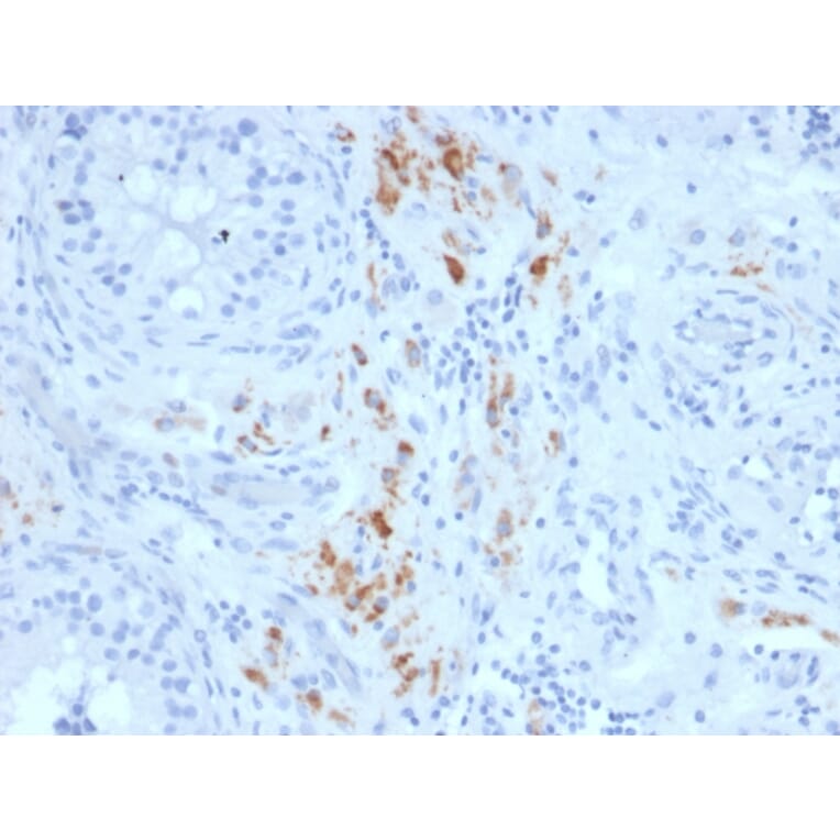 Immunohistochemistry - Anti-StAR Antibody [STAR/2140] - BSA and Azide free (A253239) - Antibodies.com