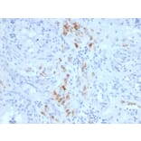 Immunohistochemistry - Anti-StAR Antibody [STAR/2140] - BSA and Azide free (A253239) - Antibodies.com