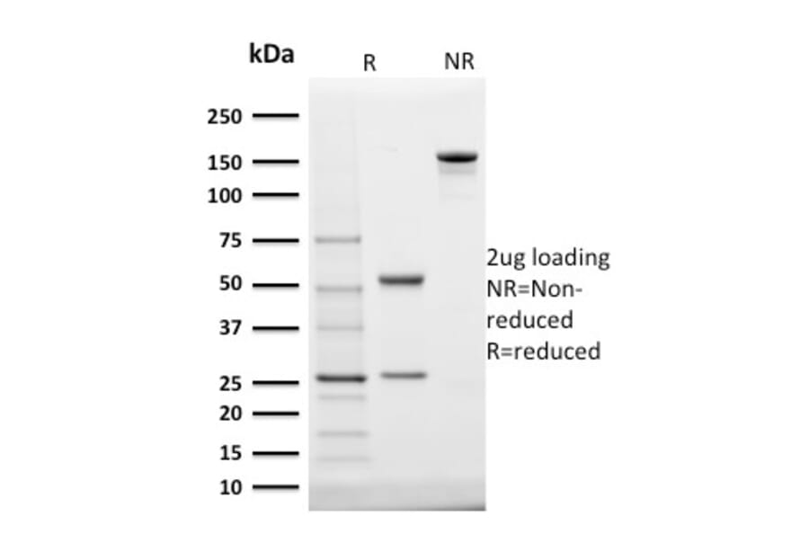 SDS-PAGE - Anti-StAR Antibody [STAR/2140] - BSA and Azide free (A253239) - Antibodies.com