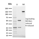 SDS-PAGE - Anti-StAR Antibody [STAR/2140] - BSA and Azide free (A253239) - Antibodies.com