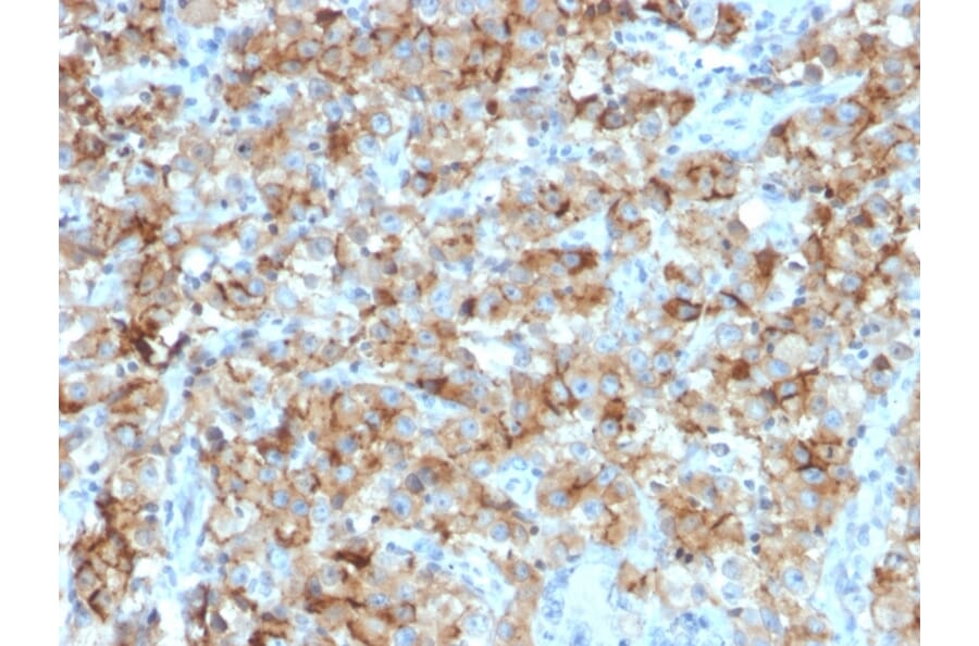 Immunohistochemistry - Anti-StAR Antibody [STAR/2154] - BSA and Azide free (A253240) - Antibodies.com