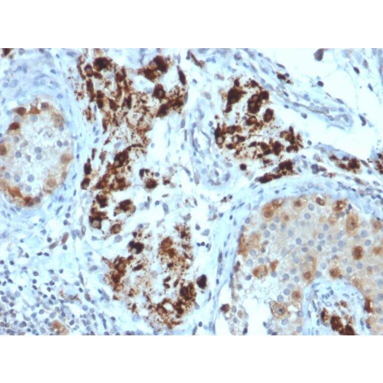 Immunohistochemistry - Anti-StAR Antibody [STAR/2154] - BSA and Azide free (A253240) - Antibodies.com