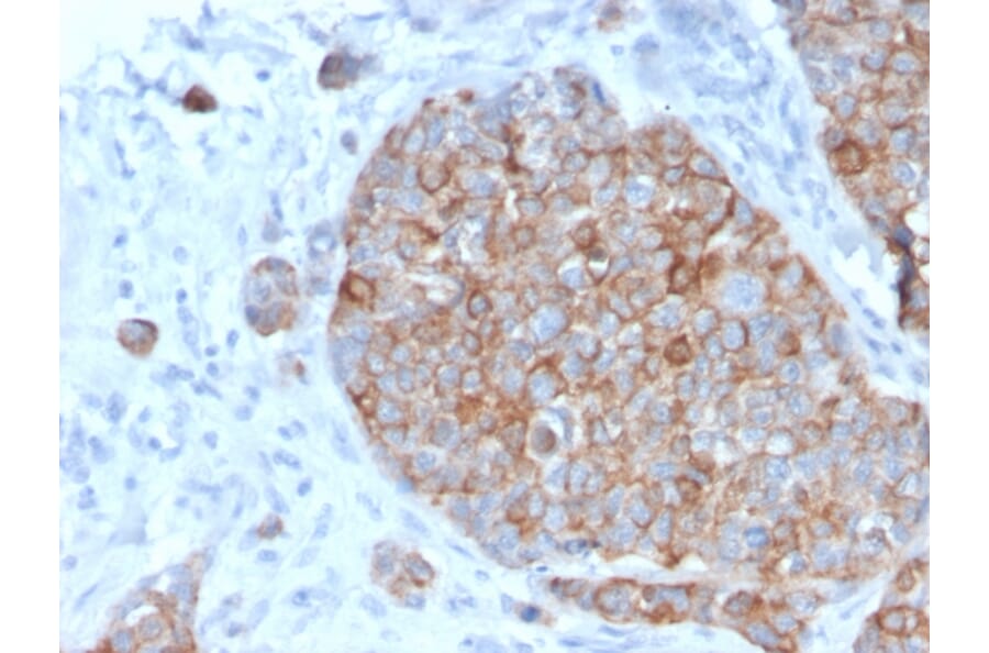 Immunohistochemistry - Anti-STAT2 Antibody [STAT2/2650] - BSA and Azide free (A253241) - Antibodies.com