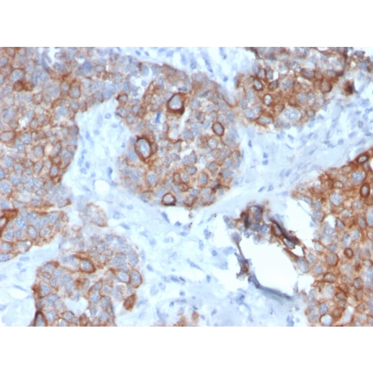 Immunohistochemistry - Anti-STAT2 Antibody [STAT2/2650] - BSA and Azide free (A253240) - Antibodies.com