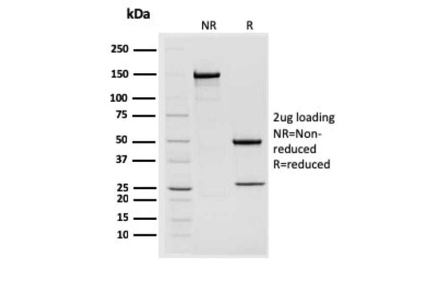 SDS-PAGE - Anti-STAT2 Antibody [STAT2/2650] - BSA and Azide free (A253241) - Antibodies.com